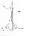 Fig. 01 - Safety suture needle assemblies and methods