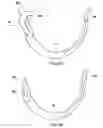 Fig. 24 - Safety suture needle assemblies and methods