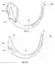 Fig. 27 - Safety suture needle assemblies and methods