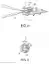 Fig. 04 - Peek threaded suture anchor