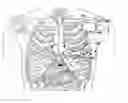 Fig. 01 - Subcutaneous defibrillation system and method using same