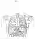Fig. 02 - Subcutaneous defibrillation system and method using same