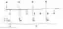 Fig. 01 - Detection of ventricular tachycardia in an active implantable medical device having an AAI operating mode