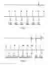 Fig. 02 - Management of mode switching for an AAI/DDD type implantable device in the presence of ventricular events of uncertain nature
