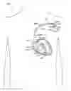 Fig. 01 - Patient management device for portably interfacing with a plurality of implantable medical devices and method thereof