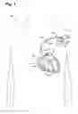 Fig. 02 - Patient management device for portably interfacing with a plurality of implantable medical devices and method thereof