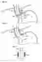 Fig. 12 - Bulimia treatment