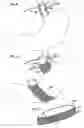 Fig. 10 - GI inflammatory disease treatment