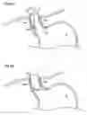 Fig. 13 - GI inflammatory disease treatment