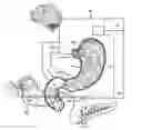 Fig. 01 - Pancreatitis treatment