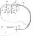 Fig. 01 - Method of intravascularly delivering stimulation leads into brain to stimulate the SPG