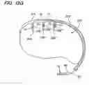Fig. 08 - Method of intravascularly delivering stimulation leads into brain to stimulate the SPG