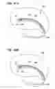 Fig. 33 - Method of intravascularly delivering stimulation leads into brain to stimulate the SPG