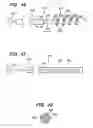 Fig. 35 - Method of intravascularly delivering stimulation leads into brain to stimulate the SPG