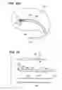 Fig. 37 - Method of intravascularly delivering stimulation leads into brain to stimulate the SPG