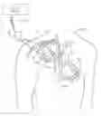 Fig. 01 - Method and apparatus for post-processing of episodes detected by a medical device
