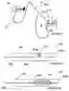 Fig. 03 - Methods and apparatus for thermally-induced renal neuromodulation