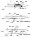 Fig. 04 - Methods and apparatus for thermally-induced renal neuromodulation