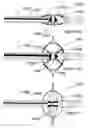 Fig. 11 - Methods and apparatus for thermally-induced renal neuromodulation