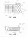Fig. 06 - Stretchable anti-buckling coiled-sheet stent