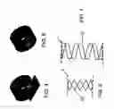 Fig. 03 - Lumen repair device with capture structure