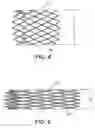 Fig. 03 - Low profile, high stretch, low dilation knit prosthetic device