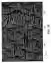 Fig. 10 - Low profile, high stretch, low dilation knit prosthetic device