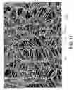 Fig. 11 - Low profile, high stretch, low dilation knit prosthetic device