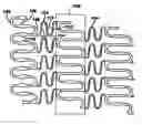 Fig. 01 - Polymeric stent having modified molecular structures in the flexible connectors and in the radial struts and the radial arcs of the hoops