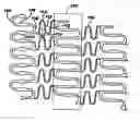 Fig. 01 - Polymeric stent having modified molecular structures in the flexible connectors and the radial arcs of the hoops