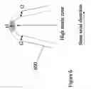 Fig. 07 - Polymeric stent having modified molecular structures in the flexible connectors and the radial arcs of the hoops