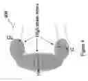 Fig. 05 - Polymeric stent having modified molecular structures in the flexible connections