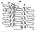Fig. 01 - Polymeric stent having modified molecular structures in both the hoops and selected segments of the flexible connectors