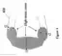Fig. 05 - Polymeric stent having modified molecular structures in both the hoops and selected segments of the flexible connectors