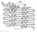 Fig. 01 - Polymeric stent having modified molecular structures in the flexible connectors and the radial struts of the hoops