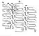 Fig. 01 - Polymeric stent having modified molecular structures in the flexible connections