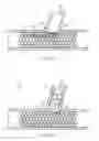 Fig. 12 - Telescoping bifurcated stent
