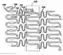 Fig. 01 - Polymeric stent having modified molecular structures in selected regions of the hoops