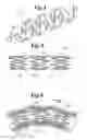 Fig. 03 - Stent with collagen