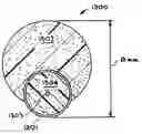 Fig. 01 - Stent with expandable foam