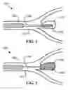 Fig. 02 - Stent with expandable foam