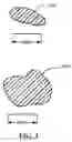 Fig. 03 - Stent with expandable foam