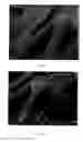 Fig. 02 - Adhesion polymers to improve stent retention