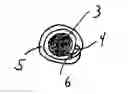 Fig. 01 - Vascular prosthesis