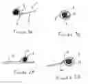 Fig. 02 - Vascular prosthesis