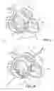 Fig. 07 - Mitral valve device using conditioned shape memory alloy
