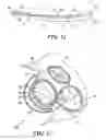Fig. 08 - Mitral valve device using conditioned shape memory alloy
