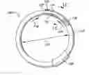 Fig. 01 - Adjustable annuloplasty ring activation system