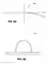 Fig. 09 - Adjustable annuloplasty ring activation system