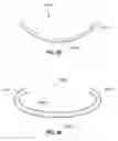 Fig. 35 - Adjustable annuloplasty ring activation system